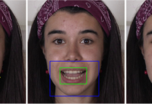 Labial Lineage Luminary